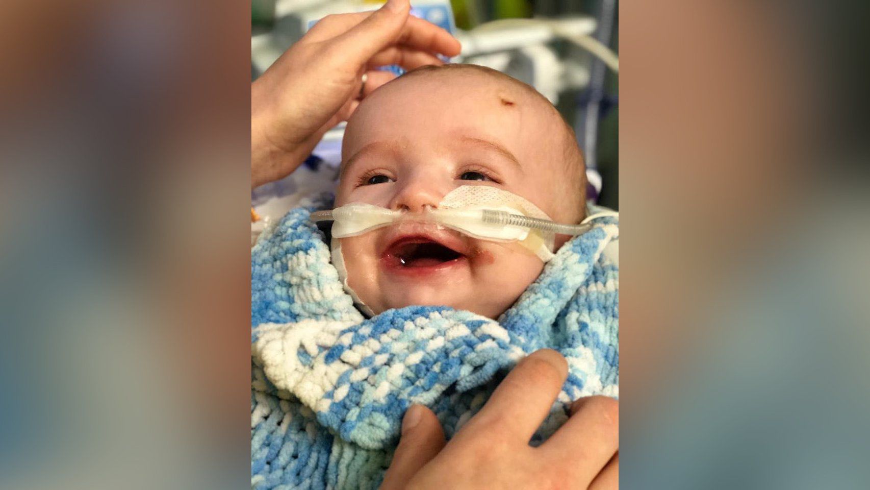 A baby woke up from a coma and smiled at his dad. Now his family is raising money to save his life